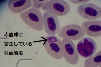 写真：赤血球に寄生している住血原虫