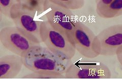 写真：赤血球の中に寄生した住血原虫