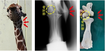 写真：首の骨折部